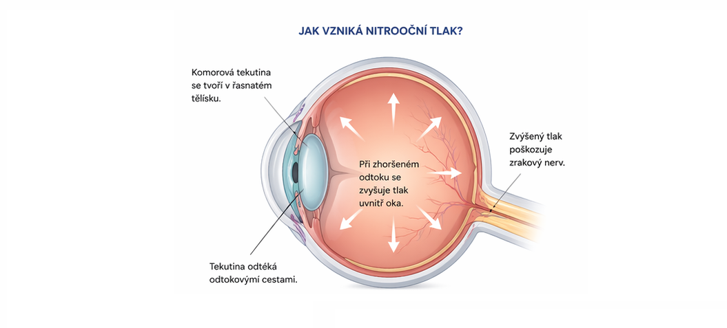 Zrakový nerv, tlak v oku
